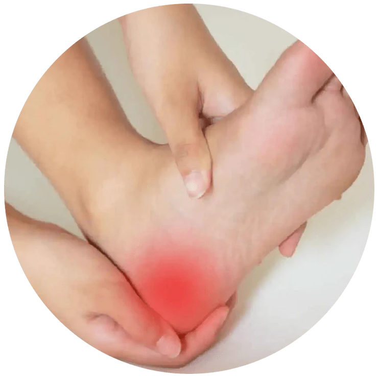 Heel Pain