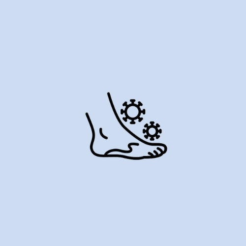 Plantar Fasciitis