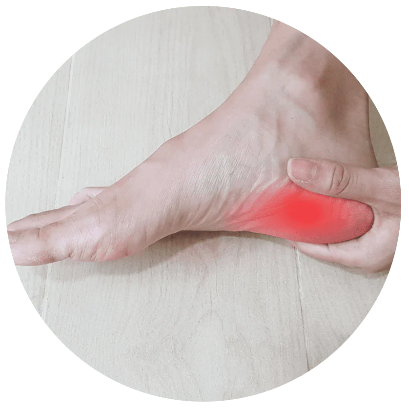 Plantar Fasciitis